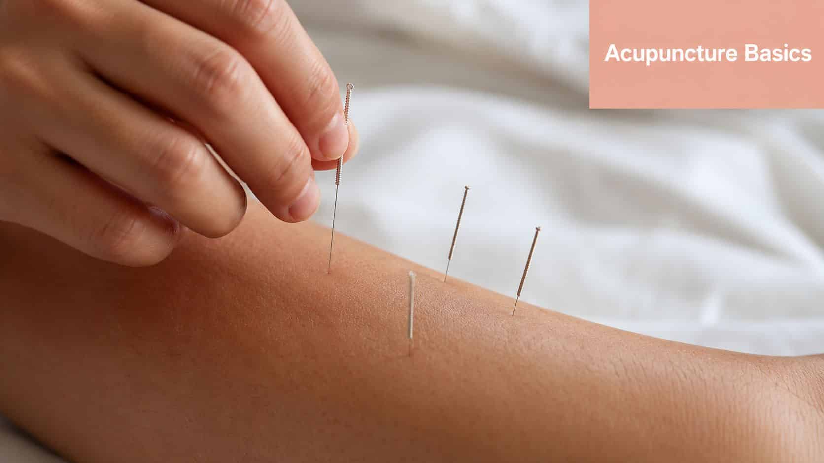 A close-up view of an acupuncture session with fine needles being inserted into a patient's leg.